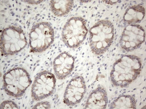 PD-L2 / PDCD1LG2 / CD273 Antibody (clone OTI12C7)