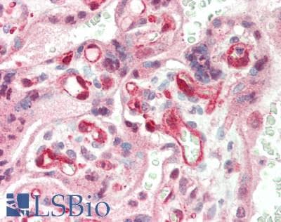 IHC-plus™ TSC22D1 / TSC22 Antibody (aa24-73)