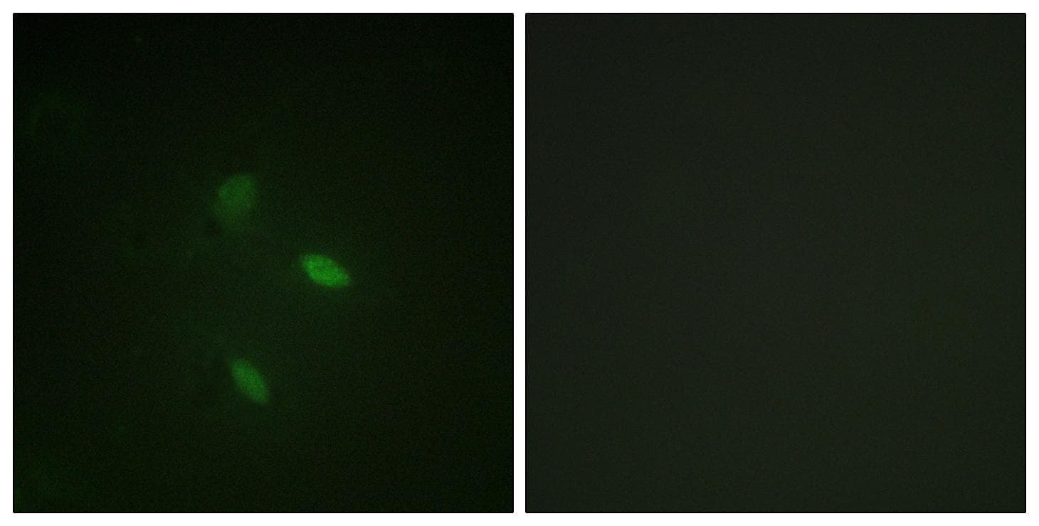 Polyclonal Rabbit anti-Human CCNE2 / Cyclin E2 Antibody (p392, IHC, IF, WB)