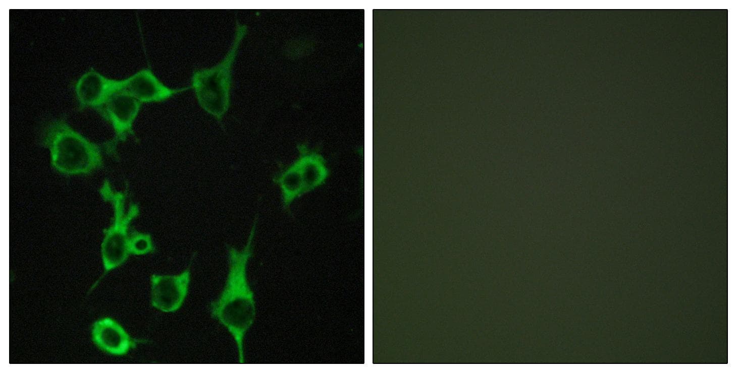 ACKR2 / CCR10 / D6 Antibody