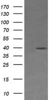 MAP2K3 / MEK3 / MKK3 Antibody (clone OTI5E2)