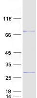 Human CHIC2 Protein (Recombinant Myc-DDK (Flag))