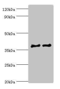 IHC-plus™ Polyclonal Rabbit anti-Human CTSV / Cathepsin V Antibody (aa105-334, IHC, WB)