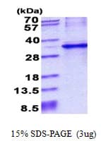 Human CYB5R1 Protein (Recombinant His)