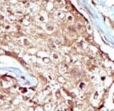 Polyclonal Rabbit anti-Human PAPSS2 Antibody (aa544-574, IHC, WB)