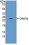 XDH / Xanthine Oxidase Antibody (aa231-416)