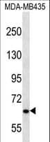 NPHP3 Antibody (aa144-173)