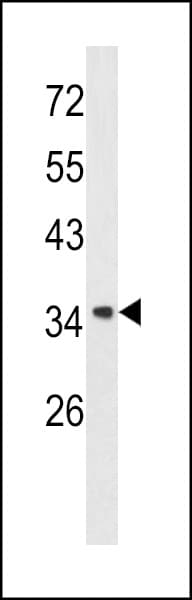 IHC-plus™ Polyclonal Rabbit anti-Human ANXA1 / Annexin A1 Antibody (aa129-158, IHC, WB)