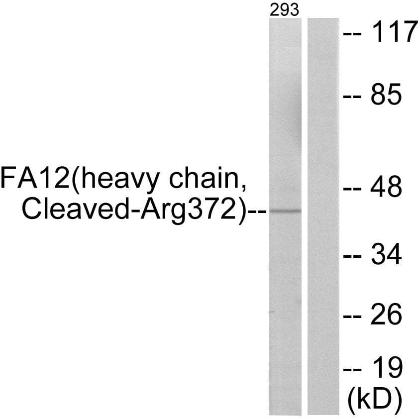 F12 / Factor XII Antibody (heavy chain, Cleaved-Arg372)