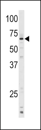 CYP1A1 Antibody (aa377-405)