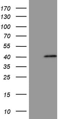 MAGEB3 Antibody (clone OTI7E2)