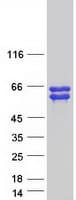 Human ANKRD34A Protein (Recombinant Myc-DDK (Flag))