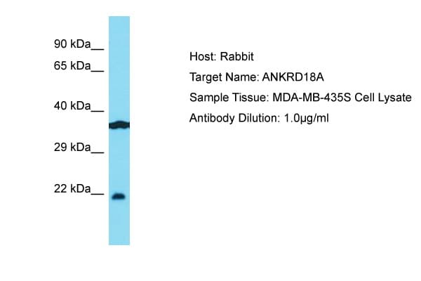 ANKRD18A Antibody (aa294-343)