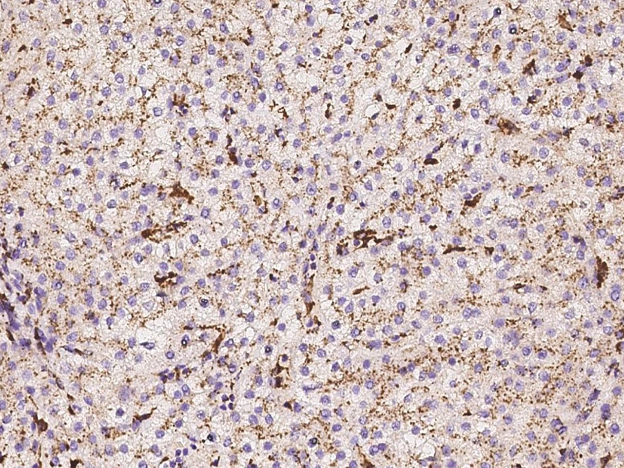 PPT1 / CLN1 Antibody