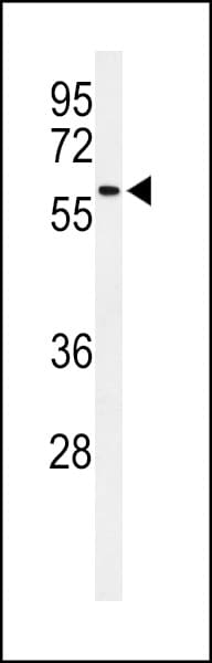 Polyclonal Rabbit anti-Human SDR / SDPR Antibody (aa109-135, IHC, WB)