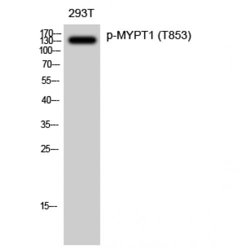 Polyclonal Rabbit anti-Human PPP1R12A / MYPT1 Antibody (590-670 aa, IHC, WB)