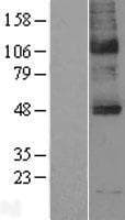 Human SLC5A5 / NIS Protein (Over-Expression Lysate Myc-DDK (Flag))
