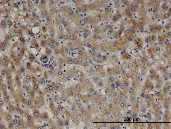 PEX11B Antibody (clone 2D2)