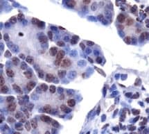 LPIN1 / Lipin 1 Antibody (Internal, DY550)