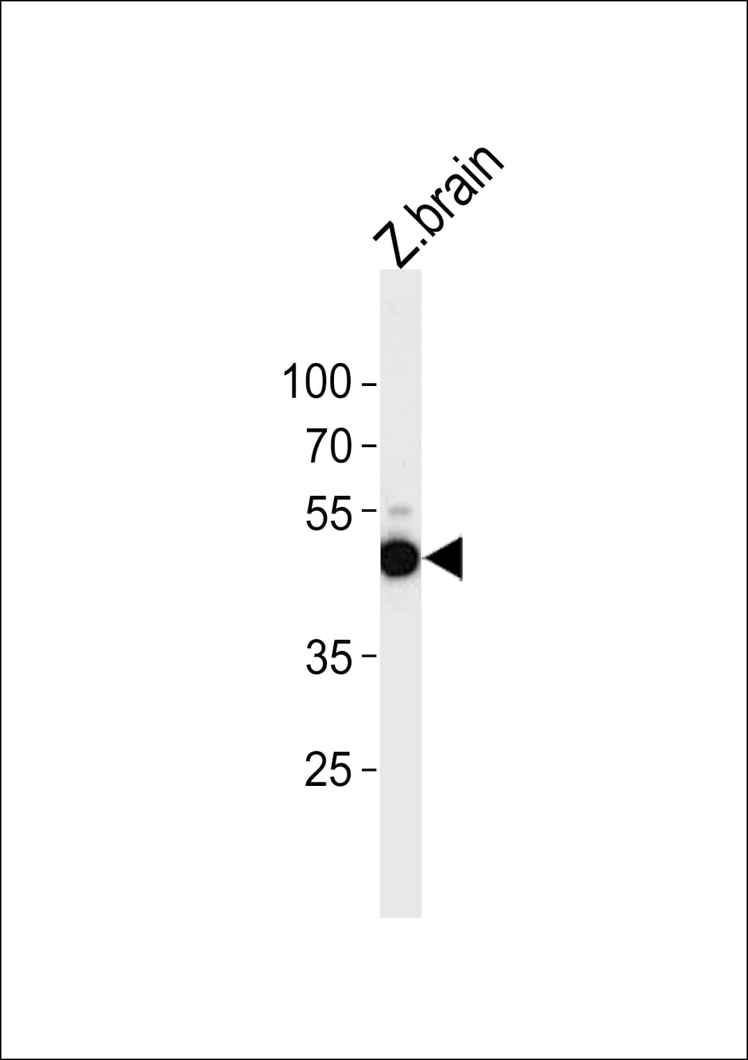APG4B / ATG4B Antibody (aa1-30)