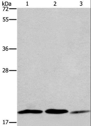 RAP1B Antibody