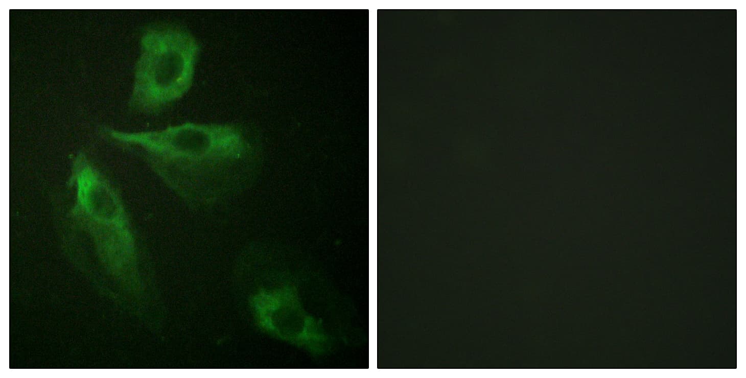 IHC-plus™ ADD1 / Adducin Alpha Antibody (aa411-460)