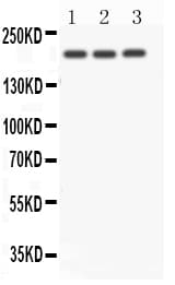 Polyclonal Rabbit anti-Human NOTCH4 Antibody (aa1805-1818, WB)