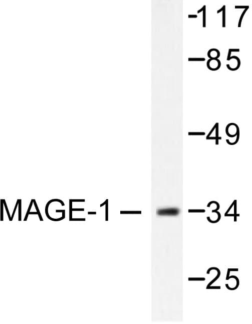 MAGEA1 / MAGE 1 Antibody (Phe293)