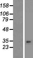 PLEKHB2 Protein (Over-Expression Lysate Myc-DDK (Flag))