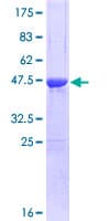 Human CSRP1 Protein (Recombinant GST)