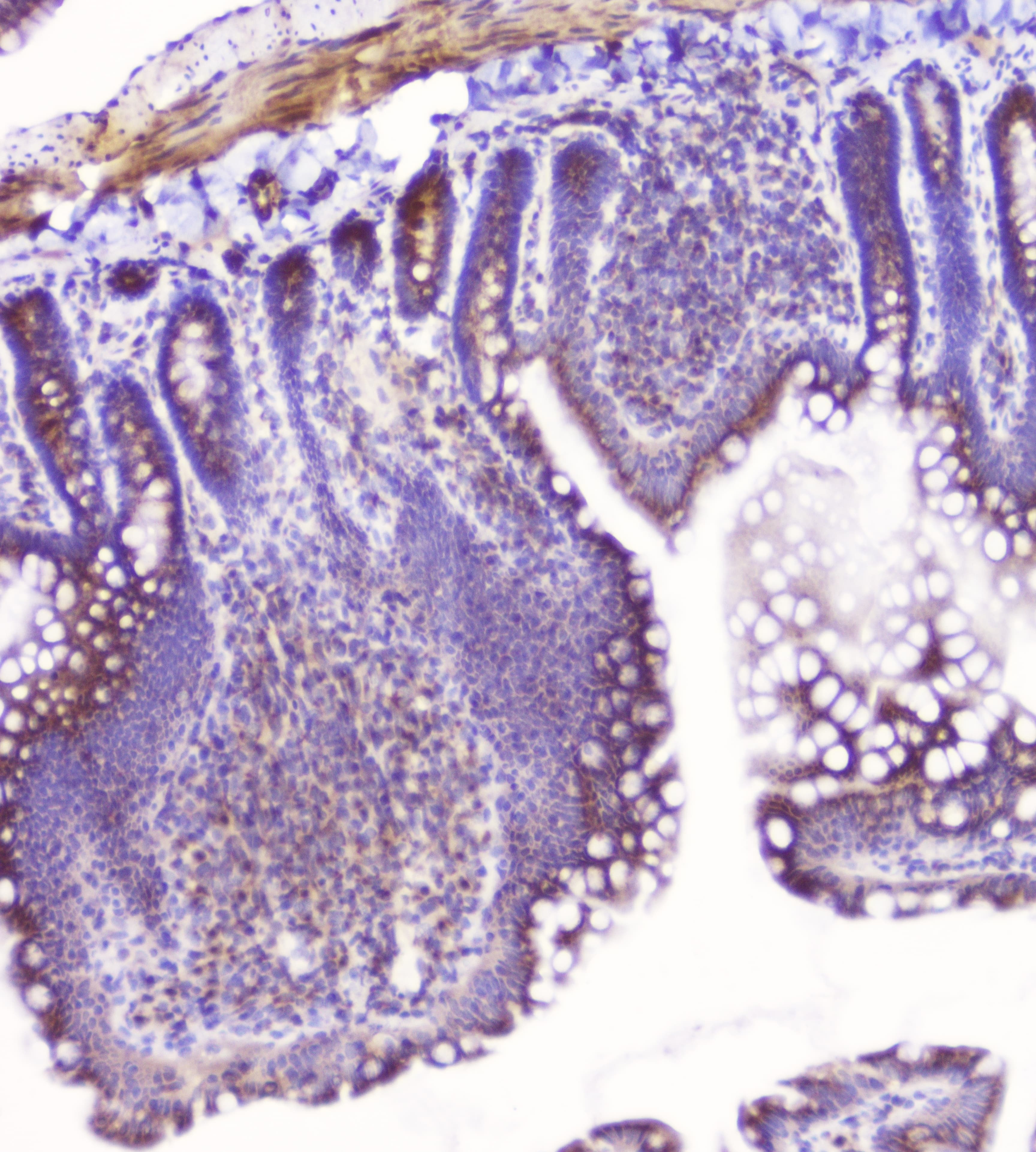 Polyclonal Rabbit anti-Human GOLGA2 / GM130 Antibody (IHC, WB)