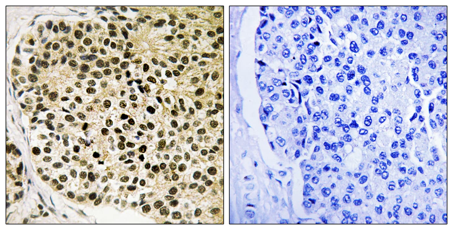 Polyclonal Rabbit anti-Human NFATC4 / NFAT3 Antibody (phospho-Ser168, IHC)