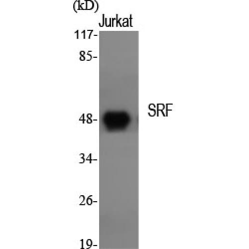 SRF / Serum Response Factor Antibody (40-120 aa)