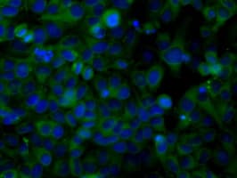 SNX9 / WISP Antibody (clone OTI1E4)