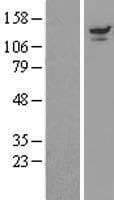Human USP8 / UBPY Protein (Over-Expression Lysate Myc-DDK (Flag))