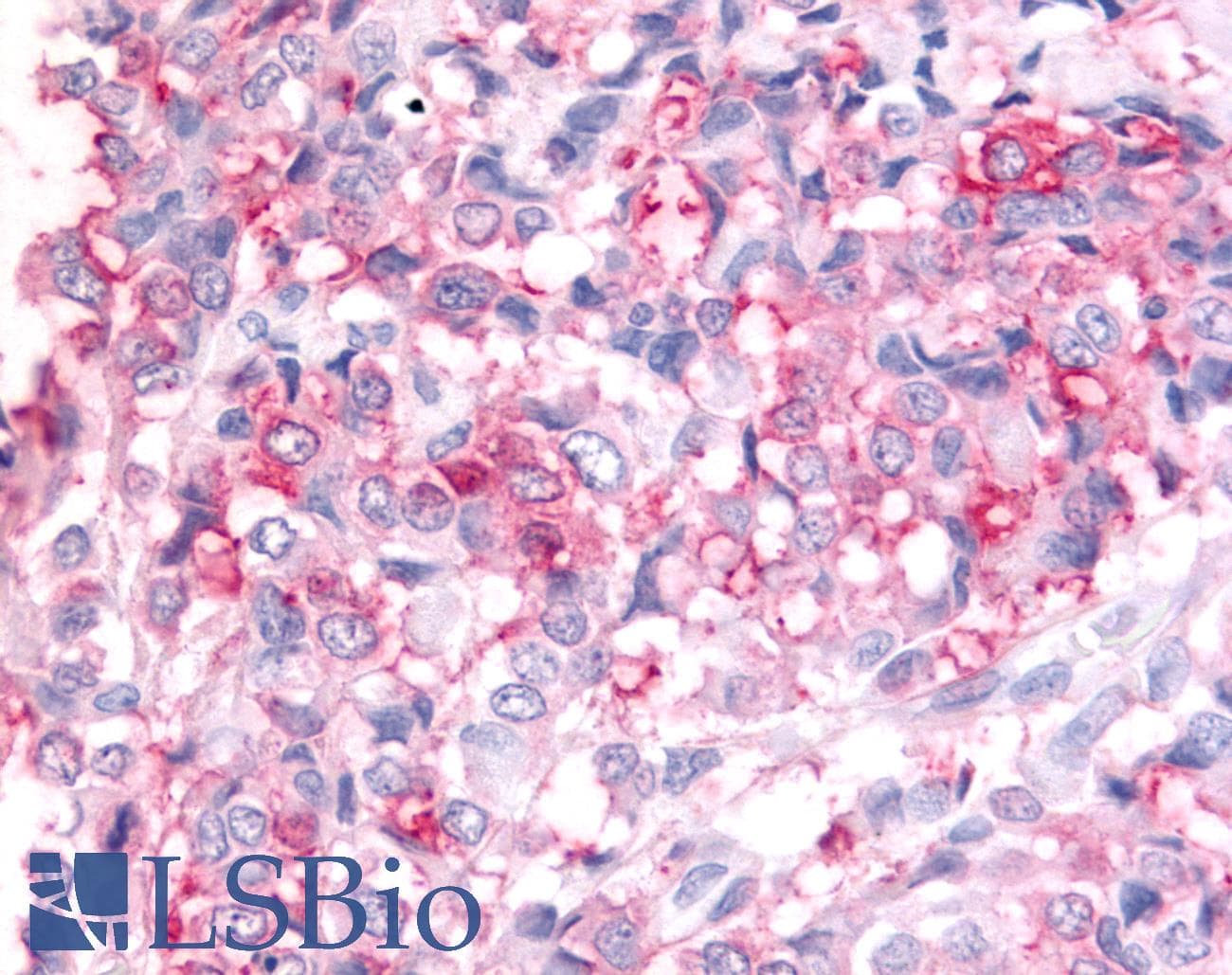 PathPlus™ Polyclonal Rabbit anti-Human ADAMTS5 Antibody (C-Terminus, IHC)