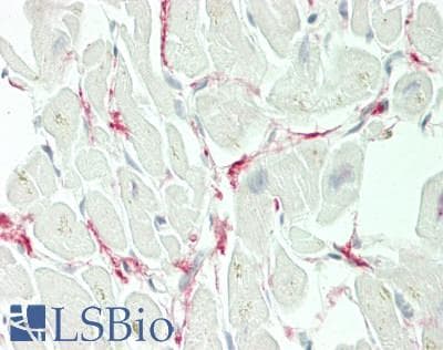 IHC-plus™ INHBB / Inhibin Beta B Antibody (Internal)