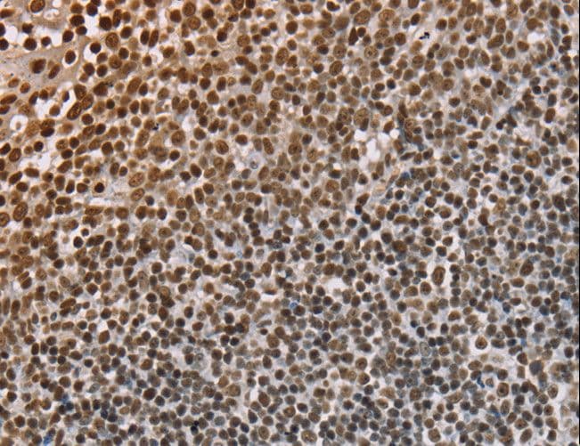 NUP50 Antibody