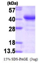 Human GYG1 / Glycogenin Protein (Recombinant 6His, N-terminus)