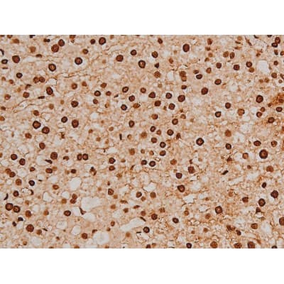 Polyclonal Rabbit anti-Human EZR / Ezrin Antibody (phospho-Tyr353, IF, WB)