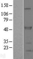 SPRED2 Protein (Over-Expression Lysate Myc-DDK (Flag))