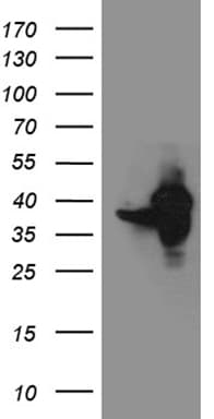 Monoclonal Mouse anti-Human GIPC1 / GIPC Antibody (clone OTI4C11, WB)