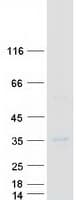 Human TNFSF14 / LIGHT Protein (Recombinant Myc-DDK (Flag))