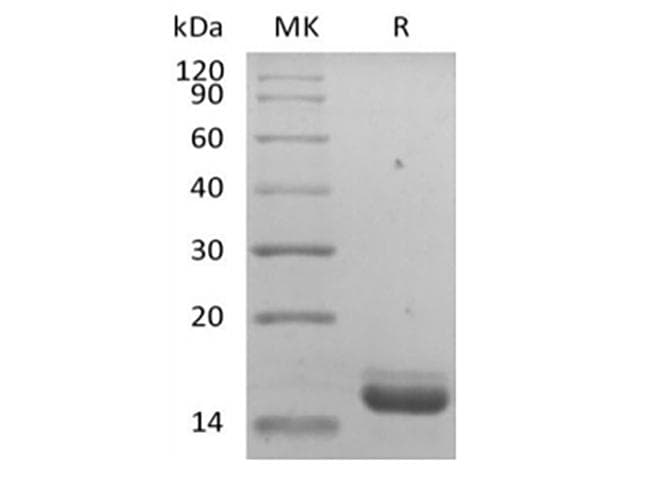 Human IL36RN / IL1F5 Protein (Recombinant)