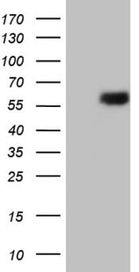 ESRRB / ERR Beta Antibody (aa1-252, clone OTI12H2)