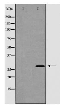 PathPlus™ CTSG / Cathepsin G Antibody