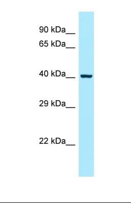 PSTPIP1 Antibody (aa42-91)