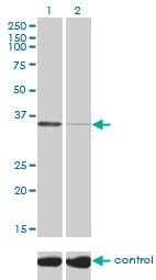 Monoclonal Mouse anti-Human TSTA3 / GDP-L-Fucose Synthase Antibody (clone 2B9, WB)