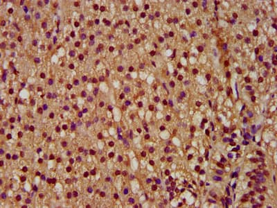 PYGO2 / Pygopus 2 Antibody