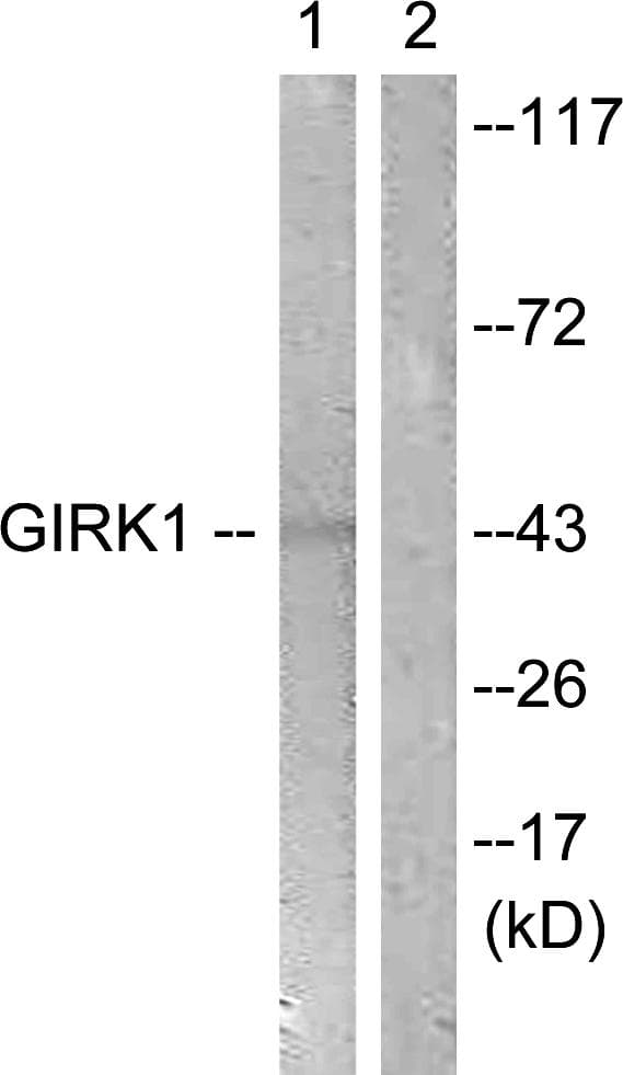 KCNJ3 / GIRK1 Antibody (p185)